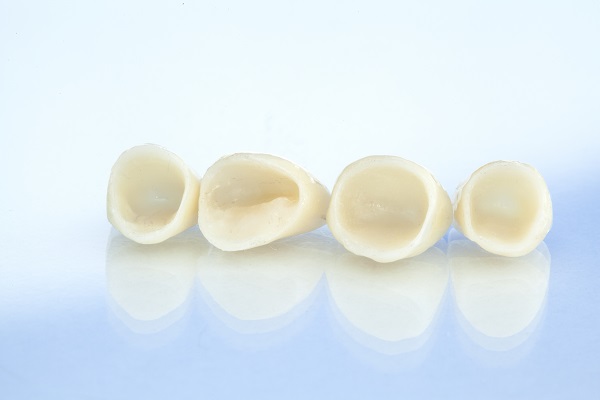 What A CEREC Dentist Can Do For You