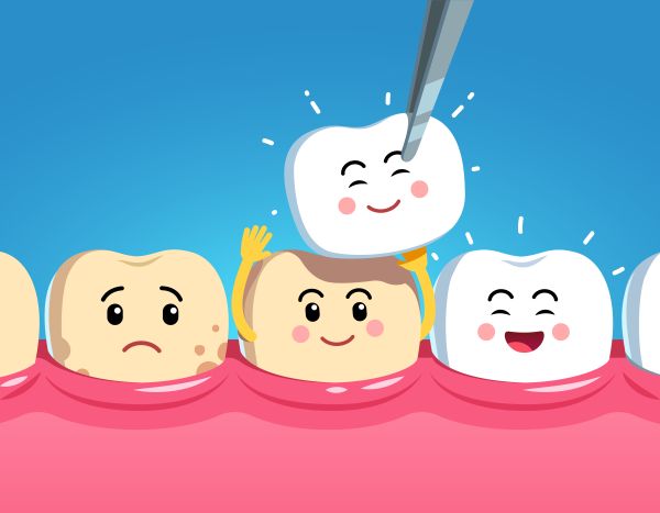 Are Dental Veneers Procedure Changes Reversible?