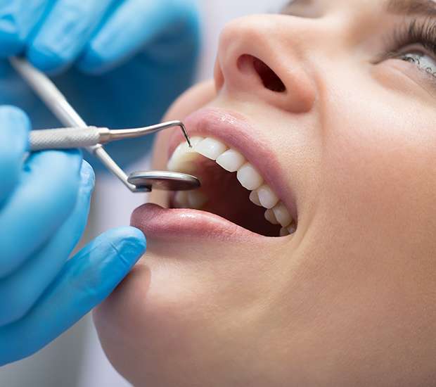 Brevard Dental Bonding