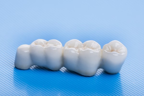 Dental Bridge: Types And Uses