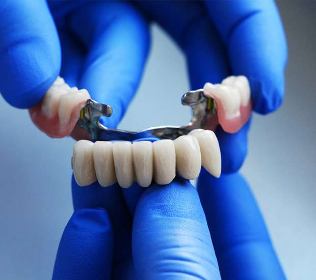 Brevard Dental Bridges