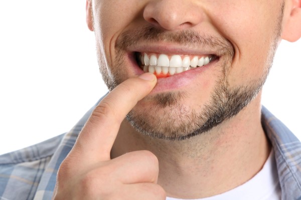 Gum Disease Treatment Options From A Family Dentist To Protect Your Teeth And Gums