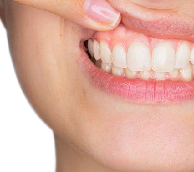 Brevard Gum Disease