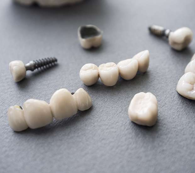 Brevard The Difference Between Dental Implants and Mini Dental Implants