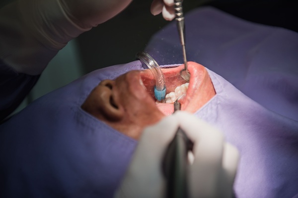 Oral Surgery Options From A General Dentist