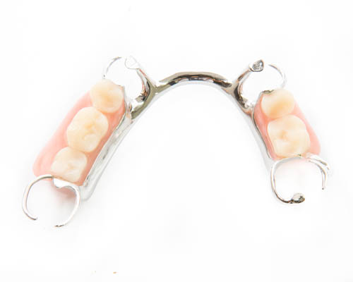 Partial Denture Solutions: Fill Gaps And Restore Confidence
