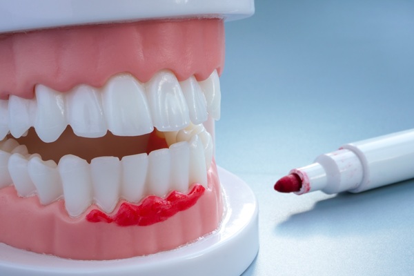 Periodontics: What You Need To Know