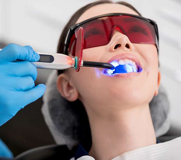 Brevard Professional Teeth Whitening
