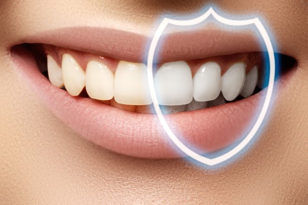 Tips For Professional Teeth Whitening